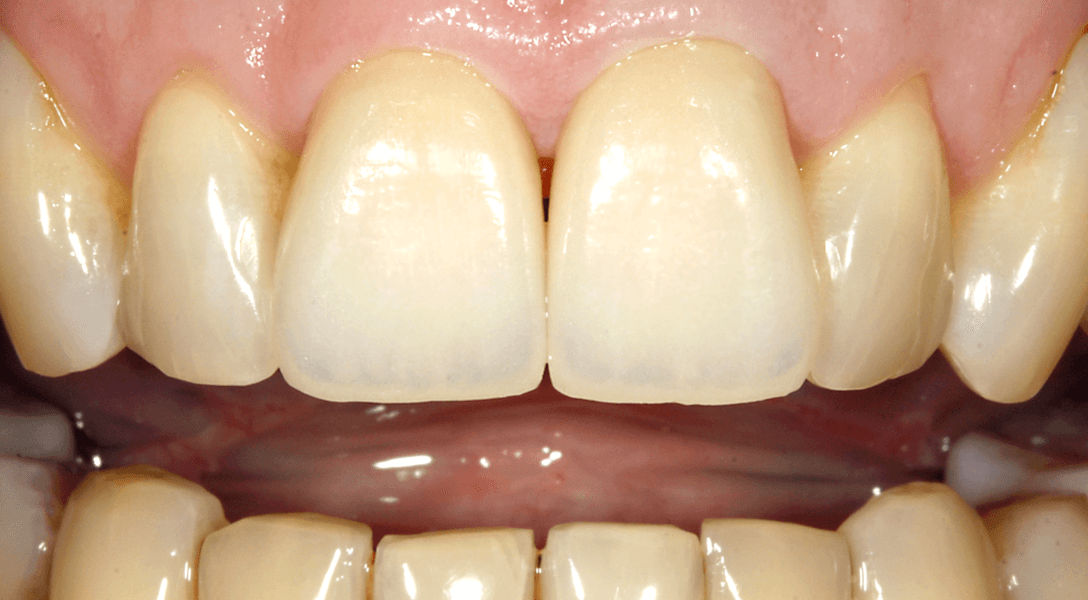 Biodentis Patienten