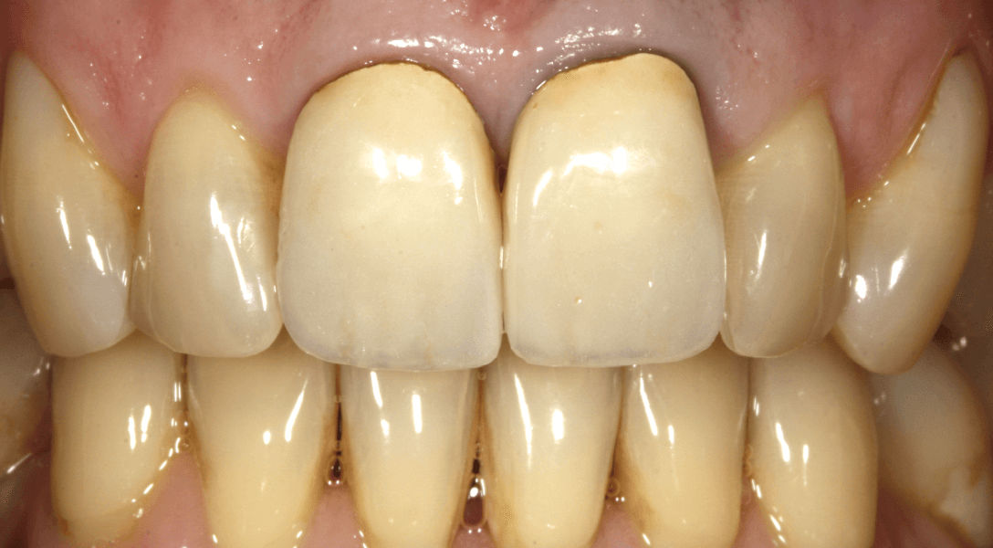 Biodentis Patienten